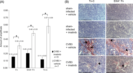 Imatinib inhibits the expression of matrix proteins in CVB3-infected hearts. (A) Effect of treatment with Imatinib on mRNA expression of total fibronectin, EIIIA+ fibronectin, and tenascin C in hearts of CVB3-infected mice. Semi-quantitative RT–PCR was evaluated by densitometric analysis (n = 4–9, mean±SEM). Statistically significant differences are indicated (Mann–Whitney test; P < 0.05*). (B) Frozen myocardial sections of CVB3-infected mice treated with Imatinib, or vehicle, respectively, from day 35 p.i. were reacted with antibodies to tenascin C (Tn-C), or EIIIA+ fibronectin (EIIIA+ Fn). Immunoreactive areas are indicated with black arrows. Sections were counterstained with Haemalaun. Scaling bars correspond to 100 µm.