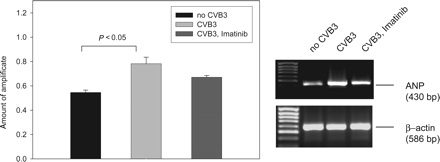 Expression of ANP precursor mRNA. Semi-quantitative RT–PCR was evaluated by densitometric analysis (n = 4–5, mean±SEM). A statistically significant difference in CVB3 infected animals from uninfected controls is indicated. The value in the presence of Imatinib was significantly different from the one in uninfected animals (P < 0.05), but not significantly different from the one in CVB3 infected, vehicle treated animals (P = 0.08). An example of the RT–PCR results is shown in the right panel (The lanes are from the same gel with identical processing, but were rearranged for better clarity.).