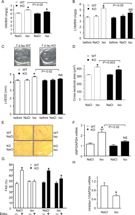 Attenuated morphological and functional deterioration following chronic isoprenaline in I-1-KO mice. (A) Heart-to-body weight ratio (HW/BW) in wild-type (WT) and I-1-KO mice treated for 7 days with NaCl or isoprenaline (n > 12 for each group). (B) Echocardiographically determined left ventricular mass normalized to body weight (LVM/BW, n ≥ 8 for each group) before implantation of the pumps (‘before’) and after 7 days of NaCl or isoprenaline, *P < 0.05 vs. NaCl; NS, not significant vs. NaCl. (C) Left ventricular end-diastolic diameter (LVEDD, n ≥ 8 for each group), *P < 0.05 vs. NaCl; NS, not significant vs. NaCl. (D) Myocyte cross-sectional area as determined from 4 µm haematoxylin/eosin-stained sections in wild type and I-1-KO treated with NaCl or isoprenaline for 7 days (n > 260 cardiac myocytes from three to four hearts from each group, *P < 0.05 vs. NaCl). (E) Sirius red-stained paraffin sections representative for three to four hearts each. (F) Quantitative reverse transcriptase–polymerase chain reaction analysis of ANP mRNA concentrations in wild-type and I-1-KO hearts (n = 4 each), *P < 0.05 vs. NaCl. (G) Fractional area shortening (FAS) before and 10 min after injection of dobutamine (20 µg/g i.p; n = 15–21), *P < 0.05 vs. before dobutamine. (H) Quantitative reverse transcriptase–polymerase chain reaction analysis of I-1 mRNA concentrations in wild-type hearts treated with NaCl or isoprenaline (n = 4 each), *P < 0.05 vs. NaCl.