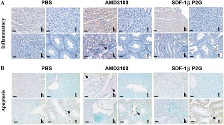 The organic toxicity of SDF-1βP2G and AMD3100 on day 14 after ischaemia. (A) Cell inflammatory reactions were examined by specific Naphthol AS-D Chloroacetate Esterase staining, bright red granulation showing the granulocytic lineage inflammatory cells. (B) Apoptotic cells were detected by transferase-mediated dUTP nick-end labelling (TUNEL) staining (cells with brown dots). h, heart; l, liver; k, kidney; and t, testis (bar = 10 µm).