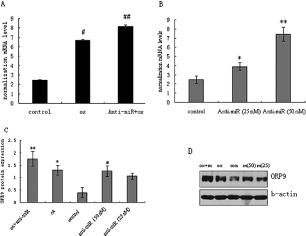 Effects of miR-125a-5p inhibitor on ORP9 expression in oxLDL-stimulated THP-1 cells. Cells were induced with PMA for 24 h, and then transfected with miR-125a-5p inhibitor for 24 h followed by oxLDL stimulation. ORP9 mRNA and protein expressions were measured by real-time PCR and western blot. Representative real-time PCR and western blot results of ORP9 expression are shown. (A) ORP9 mRNA levels (with oxLDL treatment). (B) ORP9 mRNA levels (without oxLDL treatment). (C) Respective densitometric measurement results of ORP9. (D) ORP9 protein expression. The β-actin expression was used for protein level normalization. The band densities were measured by the Quantity One 1D analysis software program. Data (mean ± SD) were obtained from three independent experiments. Band density of native THP-1 cells were defined as control, **P < 0.01 compared with control; #P < 0.01 compared with *marked group; ##P < 0.01 compared with **marked group.