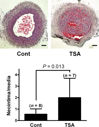Prior exposure to an HDAC inhibitor potentiates neointima formation in balloon-injured arteries. Animals were injected with either vehicle (10 mL/kg, 2% DMSO in saline) (n = 8) or TSA (1 mg/kg; at 10 mL/kg, 2% DMSO in saline) (n = 7) intraperitoneally at the time of ligation injury, 1 day before injury, and 6 days after injury. The quantification of neointimal thickening was performed 2 weeks after ligation using the computer program i-Solution. Scale bar = 100 µm.