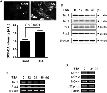 The effect of TSA on antioxidant expression and intracellular ROS levels. (A) VSMCs were incubated in the absence or presence of 0.5 µmol/L TSA for 48 h, and intracellular ROS levels were determined by staining with DCF-DA. P-values are indicated for statistically significant differences (Student's t-test). (B) VSMCs were incubated with TSA for various lengths of time, and soluble cell lysates were subjected to western blotting for Trx1/2 and Prx1/2. The results shown are representative of three independent experiments. (C) Trx1 and Prx2 mRNA levels were determined by RT–PCR. (D) VSMCs were incubated in the absence or presence of 0.5 µmol/L TSA for 24 h, and mRNA levels of various NADPH oxidase components were determined using RT–PCR.