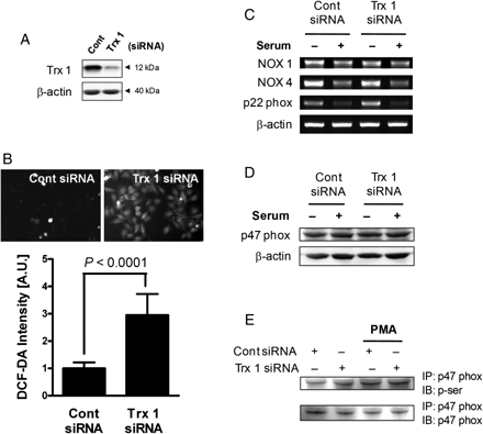 Effect of Trx 1 knockdown on the activation of the NADPH oxidase component. (A) VSMCs were transfected with Trx1-specific siRNA and cultured for 48 h, at which time the efficiency of transfection was determined by western blotting. (B) In Trx1 siRNA-transfected cells, intracellular ROS levels were determined by staining with DCF-DA. P-values are indicated for statistically significant differences (Student's t-test). (C) VSMCs transfected with Trx1-specific siRNA were incubated in the absence or presence of 5% serum for 4 h, and then the mRNA levels of NADPH oxidase components were determined by RT–PCR. (D) VSMCs transfected with Trx1-specific siRNA were incubated in the absence or presence of 5% serum for 4 h, and soluble cell lysates were subjected to immunoblot analysis for p47phox. (E) VSMCs were transfected with Trx1 siRNA for 48 h, and the lysates were then immunoprecipitated with anti-p47 phox. Phorbol myristate acetate (PMA)-treated cells were used as a positive control. The immunocomplex was subjected to immunoblotting with anti-phosphoserine or anti-p47 phox, as indicated on the right.