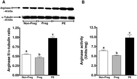 Arginase expression and activity in response to plasma. (A) A representative Western blot for arginase II expression from endothelial cells treated for 24 h with 2% plasma from non pregnant, pregnant, and preeclamptic women. Summary graph shows densitometric analysis of arginase II expression normalized to α-tubulin from 6 samples in each group. (B) Summary graph shows arginase activity in response to treatment with plasma from three groups of women. Bars represent means ± SEs. Different letters denote significant difference (P < 0.05) from each other.
