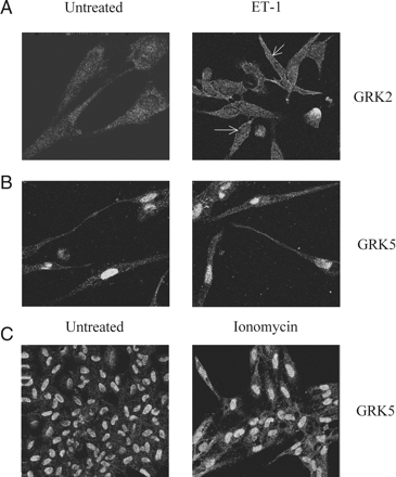 ET-1 stimulates recruitment of endogenous GRK2, but not GRK5 to the plasma membrane. MSMCs were challenged with ET-1 (50 nM) for 3 min, before fixation and processing for immunocytochemical detection of GRKs 2 and 5 (see Methods). Representative confocal images show the distribution of GRK2 and GRK5 in MSMCs. Left-hand panels are images of untreated cells, whereas the right-hand panels show: (A) GRK2 recruitment to the plasma membrane after ET-1 challenge (indicated by arrows); (B) Lack of movement of GRK5 after ET-1 challenge; (C) Redistribution of GRK5 from the nucleus to the cytoplasm after ionomycin (2 µM, 15 min) treatment. Data are representative of experiments from cells isolated from three separate animals.