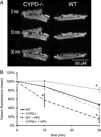 (A) Representative confocal images depicting non-pathological mitochondrial permeability transition pore (mPTP) opening occurring under basal conditions (as indicated by the redistribution of calcein from the mitochondria into the cytosol), a phenomenon which occurs to a greater extent in wild-type (WT) adult murine cardiomyocytes compared with those lacking the cyclophilin-D component (CYPD−/−) of the mPTP. (B) Non-pathological mitochondrial permeability transition pore (mPTP) opening occurred under basal conditions (as indicated by the loss of mitochondrial calcein fluorescence expressed as a percentage of the baseline fluorescence), and this phenomenon occurred to a greater extent in wild-type (WT) adult murine cardiomyocytes compared with those lacking the cyclophilin-D component (CYPD−/−) component of the mPTP. Hypoxic preconditioning (HPC) augmented this form of mPTP opening as indicated by a further loss of mitochondrial calcein fluorescence, an effect which again occurred to a greater extent in WT cardiomyocytes compared with those lacking CYPD. n = 3. *P < 0.05 when compared to WT control.