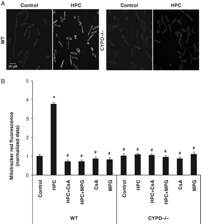 (A) Representative fluorescent images depicting an increase in reduced Mitotracker Red fluorescence (indicating enhanced mitochondrial ROS production) in WT and CYPD−/− adult murine cardiomyocytes in control and following a standard hypoxic preconditioning (HPC) protocol. (B) Hypoxic preconditioning (HPC) induced mitochondrial ROS production (as measured by an increase in reduced Mitotracker Red fluorescence) in wild-type (WT) cardiomyocytes but not CYPD−/− cardiomyocytes. This HPC-mediated increase in reduced Mitotracker Red fluorescence was abrogated in the presence of a ROS scavenger, N-2-mercaptopropionyl glycine (MPG, 300 µM) and mPTP inhibitor, Ciclosporin-A (CsA, 0.4 µM). Data are normalized to the control WT cardiomyocyte group. n = 3. *P < 0.05 vs. WT control and #P < 0.05 vs. WT HPC.