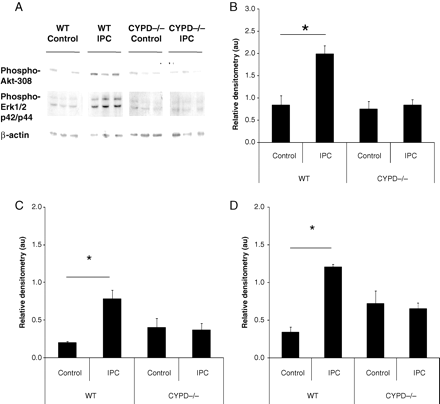 (A) Representative western blot and (B–D) relative densitometries demonstrating that ischaemic preconditioning (IPC) induced the significant phosphorylation of both Akt and Erk1/2 (p42/p44) (normalized to β-actin and measured in arbitrary units, au) in wild-type (WT) but not CYPD−/− (CYPD) adult murine hearts. n = 4 animals/treatment group. *P < 0.05.