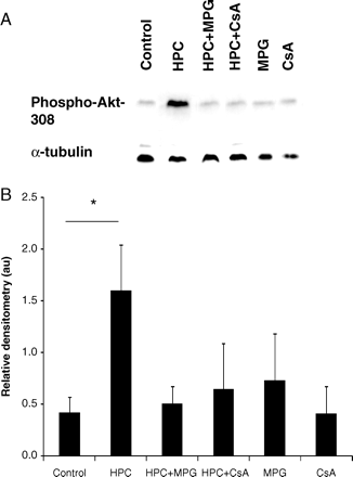 (A) Representative western blots and (B) relative densitometries demonstrating that hypoxic preconditioning (HPC) induced the significant phosphorylation of Akt (normalized to α-tubulin and measured in arbitrary units, au) in wild-type (WT) cardiomyocytes but not in CYPD−/− cardiomyocytes. This effect was abrogated in the presence of ciclosporin-A (CsA, a CYPD inhibitor) and a ROS scavenger, N-2-mercaptopropionyl glycine (MPG, 100 µM). n = 4 animals/treatment group. *P < 0.05.