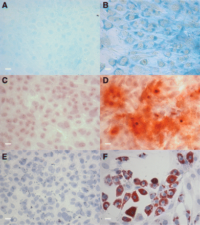 Primitive CD44+ cells were multipotential and differentiated into mesenchymal lineages. Cells cultured in SCM were plated in either control medium (A, C, and E) or medium to induce differentiation to adipocytes (B), osteocytes (D), or chondrocytes (F). Differentiation was confirmed by positive staining for (A and B) Alcian Blue for chondrocytes, (C and D) Alizarin Red S for osteocytes, and (E and F) Oil Red O for adipocytes. Scale bar = 20 μm. Representative images of five experiments.