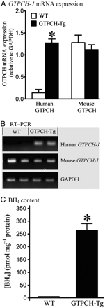 Cardiomyocyte-specific overexpression of the human GTP cyclohydrolase (GTPCH) 1 gene increased myocardial BH4 content. (A) Densitometry normalized to the GAPDH house-keeping gene showing expression of human and mouse GTPCH mRNA in hearts of transgenic (GTPCH-Tg) vs. WT littermate (WT) mice (human GTPCH mRNA was absent in WT mice and the histogram represents background densitometry values); (B) RT–PCR showing expression of human and mouse GTPCH mRNA and GAPDH in hearts of GTPCH-Tg mice vs. WT littermates; (C) BH4 levels in GTPCH-Tg and WT littermate hearts. Student's t-test was used to analyse the difference between GCTPH-Tg and WT littermate groups. *P < 0.05 vs. WT (n = 5 hearts/group).