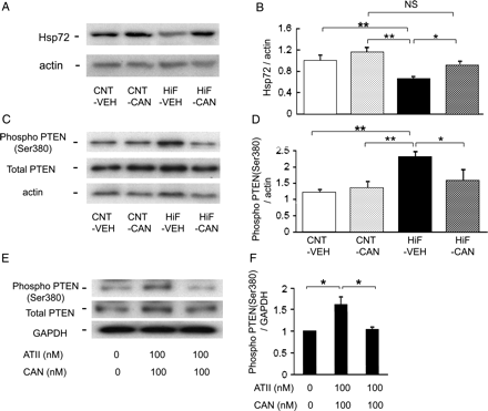 (A–D) Cardiac expression of Hsp72 and phosphorylated PTEN in hearts of rats fed a high-fat diet. Representative immunoblot bands (A) and quantification of the ratio of Hsp72 to actin (B). Representative immunoblot bands (C) and quantification of phosphorylated PTEN (D). Data are shown as the means + SEM. n = 5 for each group. (E and F) Expression levels of the phosphorylated form of PTEN 24 h after hyperthermia in cultured cardiomyocytes. Data are shown as the means + SEM. n = 5 for each group. *P < 0.05. CAN, candesartan; NS, not significant; VEH, vehicle.