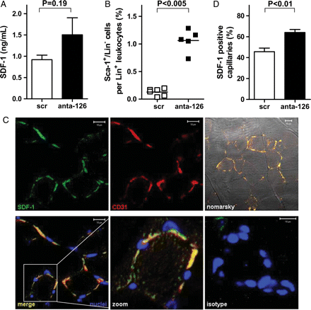 MiR-126 can alter SDF-1-expression and induce progenitor mobilization after ischaemic injury in vivo. (A) Ten days after HLI antagomir-126-treated mice showed non-significantly elevated levels of SDF-1 in the serum when compared with scramblemir-treated controls (n = 6). (B) Ten days after HLI and injection of scramblemir or antagomir-126, Sca-1+/Lin− cells were measured in whole blood, expressed as percentage of total Lin+ leucocytes (C), Immunohistochemical micrographs of immunohistochemistry of the gastrocnemius muscle after HLI showed colocalization of SDF-1 and CD31. SDF-1 was visualized with alexa-488 (green) and CD31 with alexa-568 (red). Nuclei were stained with DAPI and shown in blue, Nomarsky contrast images show muscle tissue. Scale bars represent 10 μm. (D) Quantification of microscopic images displayed that antagomir-126-treated mice have increased levels of SDF-1 positive capillaries as percentage of total number of capillaries (n = 6).