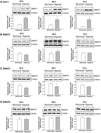 Immunoblot results and corresponding densitometry for SNAT1, 2, 3, and 5 protein expression normalized to β-actin in PAECs cultured under normoxic and hypoxic conditions for 24, 48, or 72 h. (A–D) Representative immunoblots and corresponding densitometry of studies that were performed in duplicate or triplicate using PAECs from four to five different piglets. *Different from normoxia; P < 0.05.