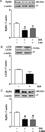 Effect of proteasome or macroautophagy inhibitors on RyR2 content in cardiomyocytes treated with geldanamycin (GA). (A) Representative western blot obtained with anti-RyR2 or anti-β-actin in total cell lysates obtained from controls or after incubation with GA or GA plus the proteasome inhibitor clasto-lactacystin-β-lactone (Lac). The bar graph shows the ratio RyR2/β-actin calculated from densitometric analysis of western blot. (B) Effect of GA on LC3-II content after incubation with GA. Representative western blot obtained with anti-LC3B or anti-β-actin. The bar graph shows the ratio LC3–II/β-actin calculated from densitometric analysis. (C) Effect of 3-methyladenine (3-MA) on RyR2 content after incubation with GA. Representative western blot obtained with anti-RyR2 or anti-β-actin in total cell lysates obtained from controls or after incubation with GA or GA and 3-MA. Bars show the ratio RyR2/β-actin calculated from densitometric analysis of western blot. Values are mean ± SEM (n = 3–9). *P < 0.05 GA, GA plus Lac, or GA plus 3-MA vs. control.