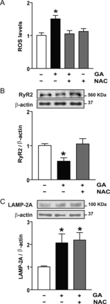 ROS generation and CMA stimulation are two independent effects of geldanamycin (GA). (A) ROS were measured by flow cytometry after 6 h with GA in the presence or absence of N-acetylcysteine (NAC). (B) Representative western blot obtained with anti-RyR2 or anti-β-actin in total cell lysates obtained from controls or after incubation with GA or GA plus NAC. Bar graph shows the ratio RyR2/β-actin. (C) Representative western blot obtained with anti-LAMP-2A or anti-β-actin in total cell lysates. The bar graph shows the ratio LAMP-2A/β-actin calculated from densitometric analysis of western blot. Values are mean ± SEM (n = 5–7). *P < 0.05 GA vs. control or GA plus NAC vs. control.
