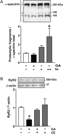 Presenilins are implicated in RyR2 degradation in cardiomyocytes treated with geldanamycin (GA). (A) Western blot representative of α-spectrin proteolysis. Asterisk indicates α-spectrin total (top) or calpain-induced proteolytic fragments (150 and 145 KDa) of α-spectrin. Ionomycin was used as positive control (Io, 0.5+ and 1++ µM). Bar graph shows the ratio within proteolytic fragments 145 KDa and total α-spectrin. (B) Representative western blot obtained with anti-RyR2 or anti-β-actin in total cell lysates from controls or after incubation with GA in the presence or absence of compound E (CE). Bar graph shows the ratio within RyR2/β-actin. Values are mean ± SEM (n = 4). *P < 0.05 GA or Io vs. control.