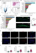 Linking local inflammation and macrophage expansion with SND in HF. (A...