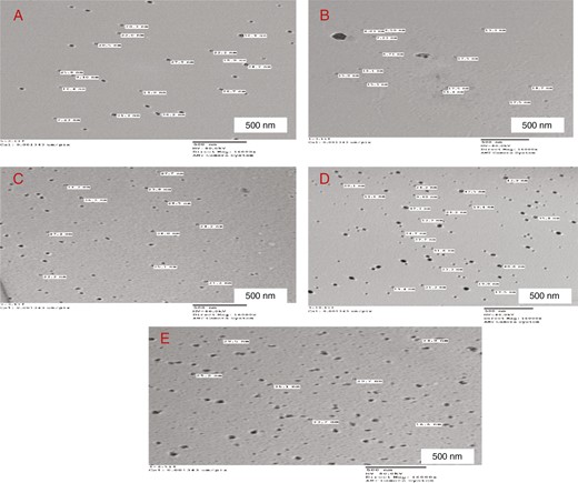 High-resolution TEM images of (a) TZ, (b) TZL4, (c) TZL8, (d) TZL12, and (e) TZM4.
