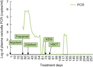 Varicella infection and response to anti-viral therapy. Disseminated varicella infection, which required multiple anti-viral therapies, was monitored by polymerase chain reaction (PCR) throughout the patient's clinical course.