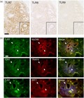 Tollâ€like receptor 7 and its downstream molecules are strongly expressed in ducts of labial salivary glands from the primary Sjögren's syndrome patients.