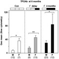 Hashimoto's thyroiditis in humans is associated with sexual dimorphism (female bias) and with autoantibodies to thyroid peroxidase (TPOAb) being a more sensitive marker of disease than autoantibodies to thyroglobulin (TgAb). Studies on NOD.H2h4 mice, the most commonly used animal model for human disease, are generally performed without regard to sex and by assaying TgAb. In the present study, we demonstrate a female bias in the development of TPOAb, not TgAb, the former more difficult to measure and requiring longer term studies than the latter. Therefore, despite these experimental handicaps, assaying TPOAb development in NOD.H2h4 mice more faithfully reflects human disease.