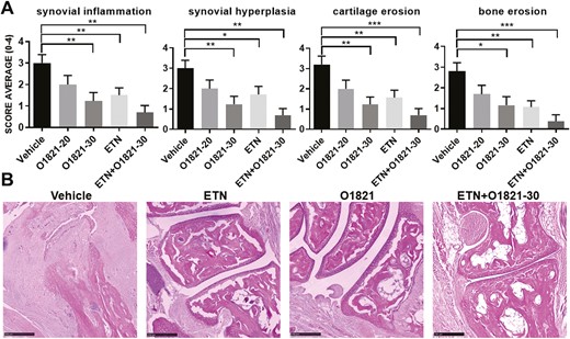 histology images and scoring. (A) O1821 30 mg/kg/day (n = 13), etanercept (ETN) (n = 13) and the combination treatment (n = 11) significantly reduced the histology scores for synovial inflammation, hyperplasia, cartilage erosions, and bone erosions, compared with controls (n = 13). The most significant reduction in cartilage and bone erosion was achieved in the combination therapy group (results shown as mean ± SEM; *P < 0.05, **P ≤ 0.0083, ***P ≤ 0.0008, rank-sum test). (B) Representative images of each treatment group. Black bar = 250 µM.
