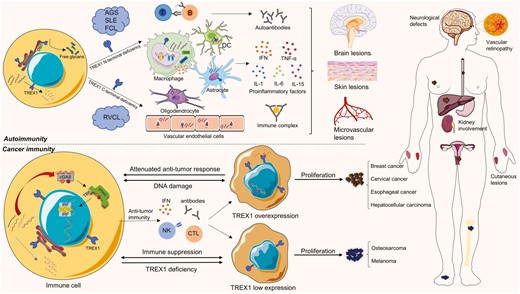 Pathogenesis of TREX1-related diseases. TREX1 deficiencies are associated with autoimmune diseases such as AGS, SLE, FCL, and RVCL. Most of AGS, SLE, and FCL are caused by N-terminal deficiencies of TREX1, while C-terminal deficiencies result in RVCL. Cells with deficient TREX1 primarily activate cGAS-STING pathways through cytosolic DNA accumulation and other immunogenic substances. The inflammatory products released by many kinds of immune cells, for example, dendritic cells (DCs), astrocytes, oligodendrocytes, macrophages, and endothelial cells, trigger a wide range of tissue inflammation in autoimmune diseases, especially the lesions in the brain, skin, and microvessels. TREX1-mutated autoimmune diseases mostly manifest neurological symptoms, lupus-like cutaneous lesions, and microvascular defects. In cancer immunity, TREX1 expression can be adaptably regulated to facilitate tumor proliferation. Since cancer cells have three powerful weapons to escape immune tracking, TREX1 overexpression is beneficial to prevent the immune response and may induce the expression of proto-oncogenes. Low TREX1 expression could be a sign of immune suppression and TREX1 deficiency. The corresponding tumor types are listed