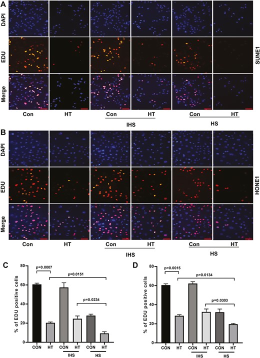 Complements enhance hyperthermia effect on suppressing NPC cell proliferation. (A) SUNE1 and (B) HONE1 cells were cultured at 37°C (con) or 43°C (hyperthermia heat therapy, HT) with 5% CO2 in a humidified incubator for 2 h. Then cells were continued to culture under 37°C with 5% CO2 in a humidified incubator, with additional 10% HS or IHS from NPC patients for 24 h. Cell proliferation of (C) SUNE1 and (D) HONE1 cells was evaluated by EDU incorporation assay. Scare bar 50 μm.