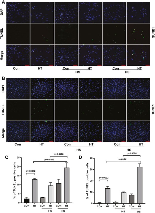 Complements enhance hyperthermia effect on promoting NPC cell apoptosis. (A) SUNE1 and (B) HONE1 cells were cultured at 37°C (con) or 43°C (hyperthermia heat therapy, HT) with 5% CO2 in a humidified incubator for 2 h. Then cells were continued to culture under 37°C with 5% CO2 in a humidified incubator, with additional 10% HS or IHS from NPC patients for 24 h. Cell apoptosis of (C) SUNE1 and (D) HONE1 cells was evaluated by TUNEL staining assay. Scare bar 50 μm.