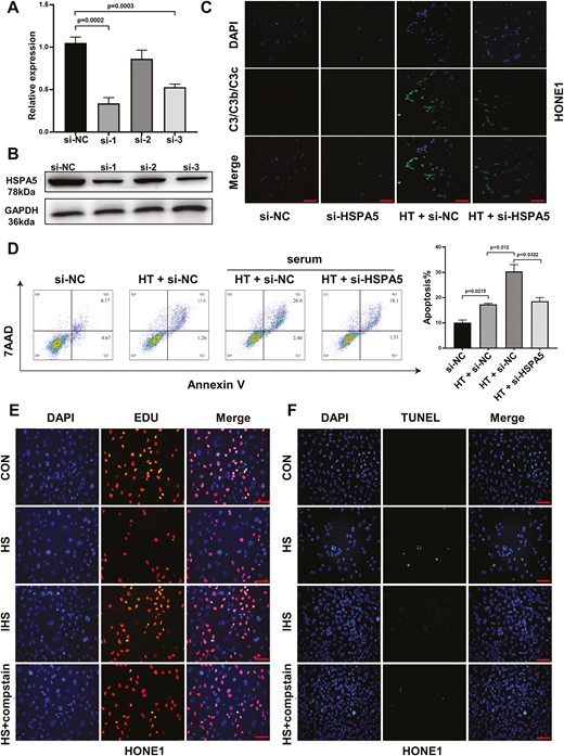 Knockdown HSPA5 abrogates the anti-tumor effect of hyperthermia in HONE1 cells. HONE1 cells were transfected with negative control (si-NC), or siRNAs targeting HSPA5. (A) The relative mRNA expression and (B) protein expression of HSPA5 in HONE1 cells were analyzed by reverse transcription-qPCR or western blot 48 h later. (C) HONE1 cells transfected with si-NC or si-HSPA5 were cultured at 37°C or 43°C hyperthermia. HS was added as a resource of complements. After culture for 24 h, the absorption of complement in HONE1 cells was analyzed by immunofluorescence staining of C3/C3b/C3c and DAPI. (D) HONE1 cells transfected with si-NC or si-HSPA5 were cultured at 37°C or 43°C HT for 48 h, with or without HS. The cell apoptosis was analyzed by Annexin V/7-AAD staining. (E, F) HONE1 cells were cultured with HS, IHS, or HS + C3 inhibitor compstatin for 48 h. The cell proliferation (E) and apoptosis (F) of HONE1 cells were evaluated by EDU staining and TUNEL staining assays. *P < 0.05, **P < 0.01, ***P < 0.001. Scare bar 50 μm.