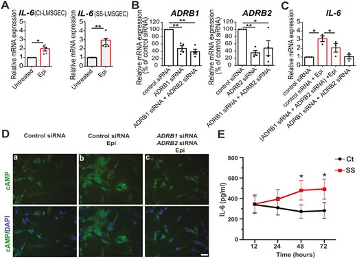 Adrenergic-mediated induction of IL-6 production by LMSGEC. (A) Relative mRNA levels of IL-6 in Ct-LMSGEC (n = 5) and SS-LMSGEC (n = 5) after stimulation with 20 μΜ epinephrine for 24 h. (B) Silencing efficiency of ADRB1 and ADRB2 in SS-LMSGEC (n = 4), based on adrenoceptors mRNA levels in LMSGEC transfected with control siRNA. (C) Relative expression of IL-6 in SS-LMSGEC (n = 3) transfected with control siRNA, ADRB1 siRNA, and ADRB2 siRNA, followed by stimulation with 20 μΜ epinephrine for 24 h. Data were normalized using ACTB mRNA levels and are represented as mean ± SEM. *P < 0.05 and **P < 0.01 by paired t-test. (D) Immunostaining of cAMP on PFA-fixed SS-LMSGEC (n = 4). Cell nuclei were visualized with DAPI. The levels of cAMP were examined in LMSGEC transfected with control siRNA, ADRB1 siRNA, and ADRB2 siRNA and were subsequently stimulated with 20 μM epinephrine for 24 h. Scale bars, 25 μm (40× magnification). (E) Time course analysis of IL-6 secretion in culture supernatants of Ct-LMSGEC (n = 6) and SS-LMSGEC (n = 5) in response to adrenergic stimulation with 20 μΜ epinephrine for 12, 24, 48, and 72 h. The results show the mean ± SEM. *P < 0.05 by unpaired t-test with Welch’s correction