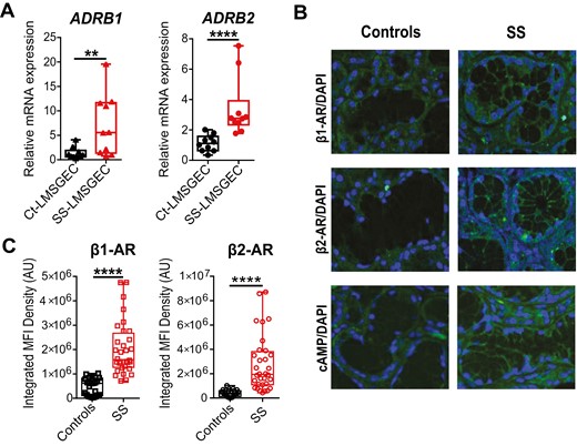 Increased β-AR signaling in LMSGEC of SS patients. (A) Baseline mRNA levels of ADRB1 and ADRB2 in cultured Ct- (n = 10) and SS-LMSGEC (n = 10). Data are represented as boxplots, with median (horizontal line), interquartile range (IQR; box), and whiskers extending to the highest and lowest values. **P < 0.01 and ****P < 0.0001 by Mann–Whitney test. (B) Representative confocal images from LMSG sections derived from Cts (n = 3) and SS patients (n = 4) stained with anti-ADRB1, anti-ADRB2 and anti-cAMP. Cell nuclei were visualized with DAPI staining (40× magnification). Control immunofluorescence without primary antibody showed no staining. (C) Quantification of immunofluorescence after β1-AR and β2-AR staining in LMSGs from Cts (n = 3) and SS patients (n = 4). Values from integrated MFI per acini are depicted as boxplots, with median (horizontal line), interquartile range (IQR; box) and whiskers extending to the highest and lowest values. ****P < 0.0001 by Mann–Whitney test