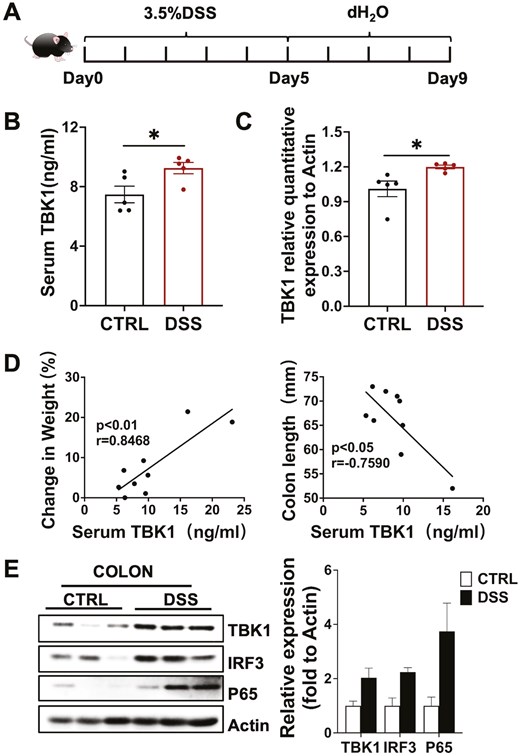 TBK1 levels are correlated with the disease severity of colitis. (A) Establishment of DSS-induced colitis model. (B) Serum TBK1 protein was detected by ELISA in both DSS and Control groups (n = 5/group). (C) Colon TBK1 mRNA was detected by real-time quantitative PCR (n = 5/group). P values determined by a two-tailed Student’s t-test. (D) The correlation between serum TBK1 levels and the severity of colitis, including colon length and percent body weight loss (n = 9/group). Statistically significant correlations were determined using linear regression. (E) The expression of TBK1 and the activation of TBK1-IRF3/NF-κB signaling in colon tissue was detected by western blot (n = 3/group). Data are presented as the mean ± SEM. *P < 0.05; **P < 0.01; ***P < 0.001. ns, not statistically significant