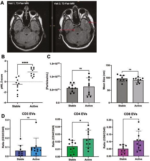 levels of CD4+ and CD8+ EVs are significantly increased in individuals with RRMS active disease. (A) Representative image of increased number of lesions (arrows) in an individual with RRMS. The formation of two new lesions was detected on T2-FLAIR axial MRI after eight months. (B) Individuals deemed active (failed to meet NEDA-3 criteria) had significantly greater levels of pNfL compared to stable individuals with RRMS (p < 0.0001; n = 9–10). (C) No significant differences in the concentration or mean size of plasma EVs were observed in active MS vs stable MS (n = 9–10). (D) In plasma, levels of CD4+ and CD8+ EVs were significantly greater in active MS vs stable MS. *P < 0.05. Error bars represent mean ± SEM.