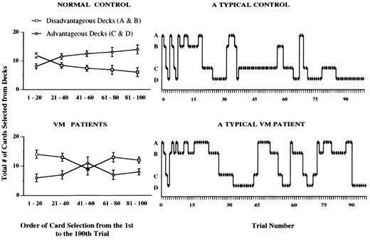  (Left panels) Card selection on the gambling task as a function of group (normal control, VM patients), deck type (disadvantageous versus advantageous), and trial block. Normal control subjects (n = 82) shifted their selection of cards towards the advantageous decks. The VM frontal patients (n = 15) opted for the disadvantageous decks. (Right panels) Profiles of card selections (from the first to the 100th selection) obtained from a typical control and a typical VM patient. Although the VM patient made numerous switches, he returned more often to the disadvantageous decks.