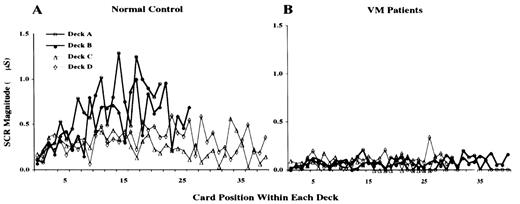  Magnitudes of anticipatory SCRs as a function of group [normal control (A) (n = 12) versus VM patients (B) (n = 7)], deck and card position within each deck. Note that control subjects gradually began to generate high-amplitude SCRs to the disadvantageous decks. The VM patients failed to do so.