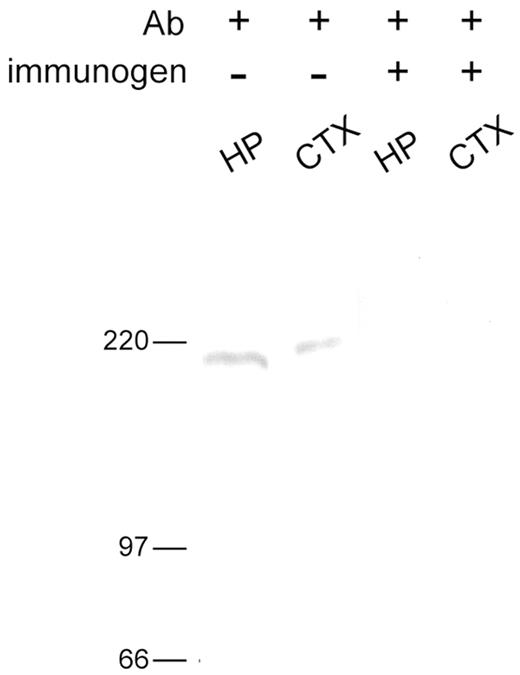 Specificity of the anti-ErbB4 antiserum in recognizing ErbB4 protein in the cerebral cortex (CTX) and hippocampus (HP). The Western blots shows that a band of ∼185 kDa, which corresponds to the predicted size of ErbB4 protein, is detected in the cortex and the hippocampus of P1 rats. No signal is detected in the blot incubated with the anti-ErbB4 antiserum preabsorbed with the immunogen.