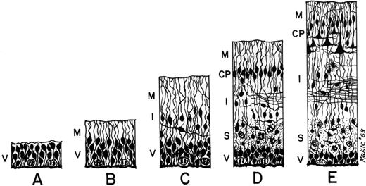 Schematic drawing of five stages (A–E) in the development of the vertebrate central nervous system. Abbreviations: CP, cortical plate; I, intermediate zone; M, marginal zone; S, subventricular zone; V, ventricular zone.
