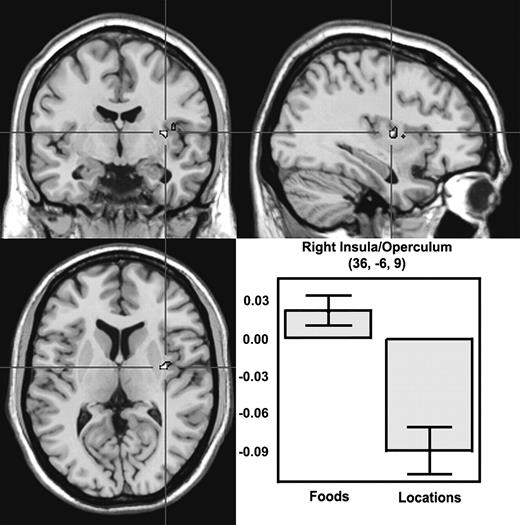 Viewing food pictures elicits activity in insula/operculum. A high-resolution anatomical scan showing activity in right insula/operculum associated with viewing pictures of food items. The bar graph displays the average percent signal change in the right insula/operculum cluster for all nine subjects during a period between 4 and 14 s post-stimulus. The y-axis indicates percent signal change relative to signal baseline, with error bars representing ± 1 SEM of the subjects. The data shown in the bar graph were obtained in the random effects contrast of foods > locations with P < 0.005.