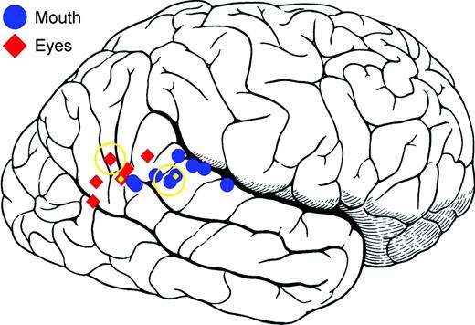 Centers from the current study, prior functional neuroimaging studies of observed eye and mouth movements, and the means of the prior studies are shown projected (in the lateral–medial direction) onto the right lateral brain surface. Eye activations (red diamonds) were localized posterior to mouth activations (blue circles). This informal meta-analysis indicates an anterior–inferior to posterior–superior gradient for mouth and eye activations. Centers from the present study are indicated by open gold circles. Mean centers are indicated by gold diamonds. Centers of activation are taken from: Calvert et al., 1997; Puce et al., 1998; Wicker et al., 1998; Hoffman and Haxby, 2000; Dubeau et al., 2001; Pelphrey et al., 2004a; Calvert and Campbell, 2003; Santi et al., 2003.