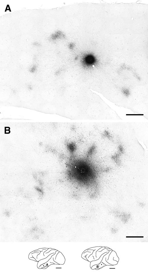 Two representative examples of labeled horizontal axons and terminal patches in tangential TE sections following BDA injections (injection size: A, 400 μm; B, 580 μm in diameter). These sections were cut primarily through layer 3. Patch-like terminal clusters are clearly visible at varying distances from the injection sites. The schematic drawings of the brain lateral view at the bottom show the locations of the photographs and injection sites as frames and dots, respectively. Scale bars: 1 mm in the photographs; 1 cm in the drawings.