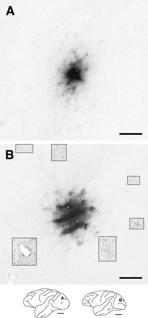 Two representative examples of intrinsic horizontal axons and terminal patches in V1. These photographs exhibit the labeled tangential sections of V1 following BDA injections (injection size: A, 250 μm; B, 350 μm in diameter). The contrast in portions of the photograph was enhanced to visualize far-reaching labeled horizontal axons (B; insets). All labeling conventions are as detailed in Figure 3.