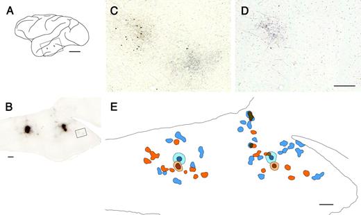 Segregation of horizontal projections from adjacent cortical sites in TE. (A) The locations of paired injections of BDA (orange) and PHA-L (blue) on the lateral view of the brain. The frame indicates the approximate location of the photograph in B. (B) Double staining of BDA- and/or PHA-L-labeled horizontal axons in a tangential section. (C) High-power view of the patches within the frame in B. The BDA- and PHA-L-labeled terminal patches were visualized as brown (top left) and black (bottom right) reaction products, respectively. (D) The adjacent section was stained for BDA labeling alone, giving a black reaction product. (E) Schematic drawing of BDA- and/or PHA-L-labeled patches in the tangential section shown in B. The orange represents BDA-labeled patches, while blue represents patches labeled by PHA-L. The regions in which the two labels overlapped are shaded with both orange and blue. The striped region indicates the injection site. Light blue and light orange indicate the individual injection haloes. Scale bars: 1 cm in A; 1 mm in B and E; and 300 μm in C and D.