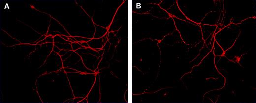 Representative photomicrographs of MAP2 immunocytochemistry in primary cortical neurons obtained from 1-day-old pups born from vehicle- (A) and WIN-exposed dams during pregnancy (B). Surviving neurons were stained with anti-MAP-2 antibody and observed under a fluorescent microscope.