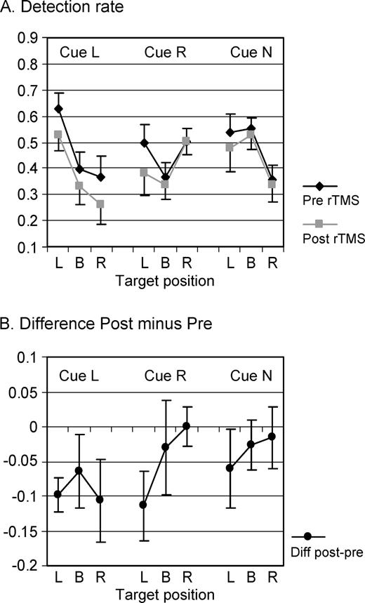Effects of right posterior parietal rTMS on target detection with no significant change over time of testing. Average detection rate and standard errors in all nine conditions (three Cues × three Targets) and collapsed over 30 min of testing (A) during baseline (pre-rTMS) and following 25 min of 1 Hz rTMS (post-rTMS) and (B) represented as changes in correct target detection after rTMS (difference values Post minus Pre, negative values correspond to impaired detection rate). The data shown are identical to Figure 4A, except for reordering to better represent the effects of TMS. rTMS affected target detection in left-cue conditions irrespective of target position (Cue L, P < 0.01) and impaired left-target detection following right cueing (Cue R/Target L, P < 0.05). No significant effects were observed for neutral cues (Cue N).