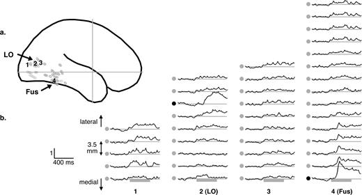 Spatial distribution of gamma responses: example along four electrode tracks in one subject. (a) Localization of the four electrode tracks in the extrastriate visual cortex of a single patient. Tracks number 2 and 4 explore the LO region and the fusiform gyrus respectively. (b) Time-course of the 30–130 Hz Z-transformed power at each recording sites along the four tracks. The two responsive contacts are indicated by black dots. Adjacent contacts (distance between contacts = 3.5 mm) were only weakly responsive, suggesting that the region generating the gamma oscillations has a limited spatial extent, in the range of 5 mm.