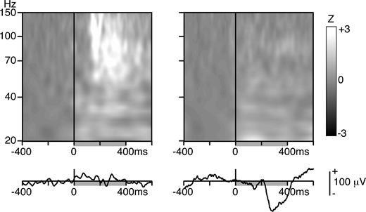 Gamma oscillations and evoked potentials are not systematically colocalized. Large gamma oscillations could be observed at recording sites not displaying a clear evoked response (left, activity in LO). Conversely, large evoked responses could be obtained without concomitant gamma oscillations (right, activity in the lingual gyrus).