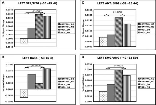 Percent signal change at locations of peak activity in temporal, frontal and parietal areas during left hand gesture planning. Panels show percent signal change for each condition in data extracted from regions of peak activity in left posterior temporal (A), inferior frontal (B) and posterior parietal cortices (C, D). The same procedure as described in Figure 3 was used.